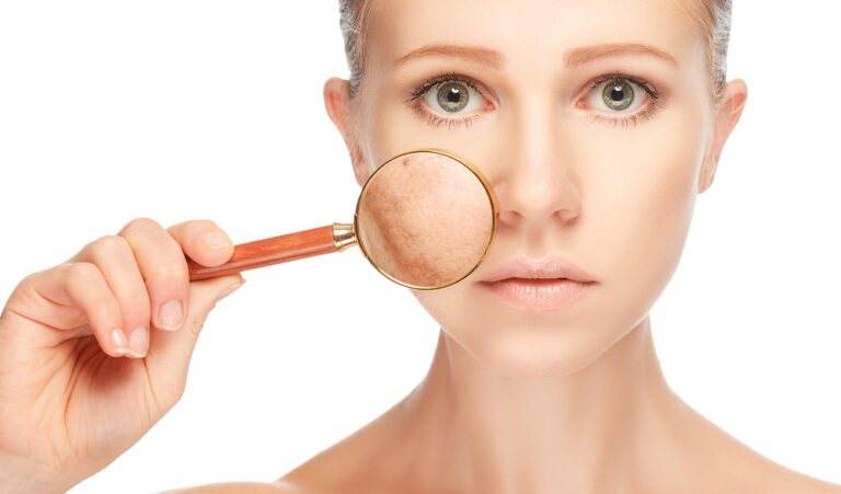 Unlocking a Brighter Complexion: Understanding And Treating Hyperpigmentation