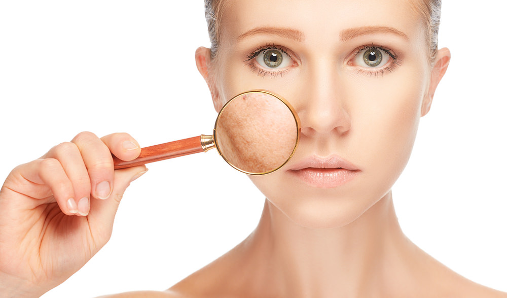 Unlocking a Brighter Complexion: Understanding And Treating Hyperpigmentation