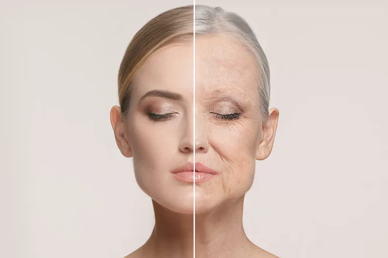 The Science Of Skin Aging: Understanding Wrinkles And Loss Of Elasticity