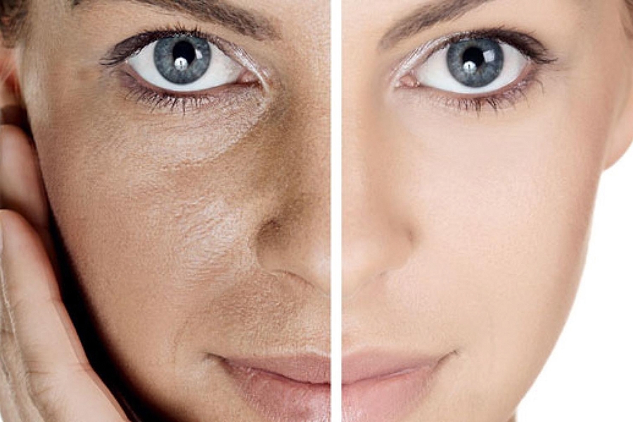 The Truth About Open Pores – Can You Really Shrink Them?